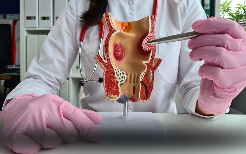 دکتر سعید نجاری جراح بیماری های مقعدی