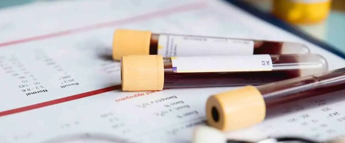 مراحل ثبت‌نام و آماده‌سازی برای چکاپ