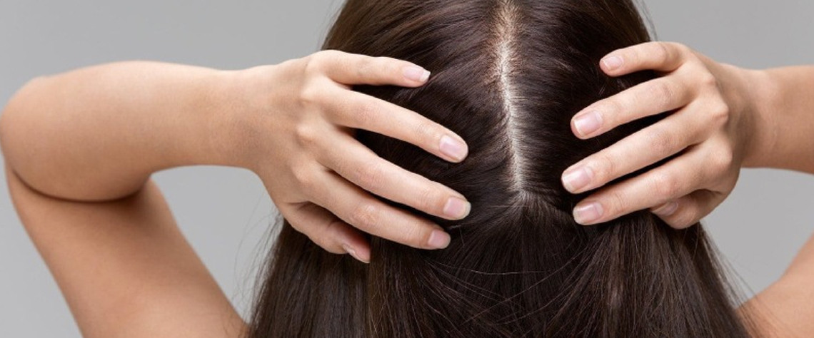 دلایل ریزش مو در مردان و زنان