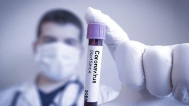 Coronavirus / Covid بیماری 19