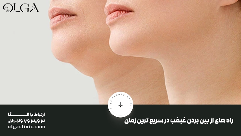 راه های از بین‌ بردن غبغب در سریع ترین زمان